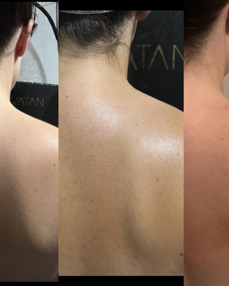 Before, during and after express tan results