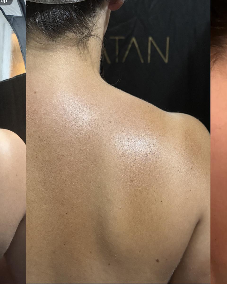 Clients back and shoulders showing the results of the Express Original after 2 hour rinse off